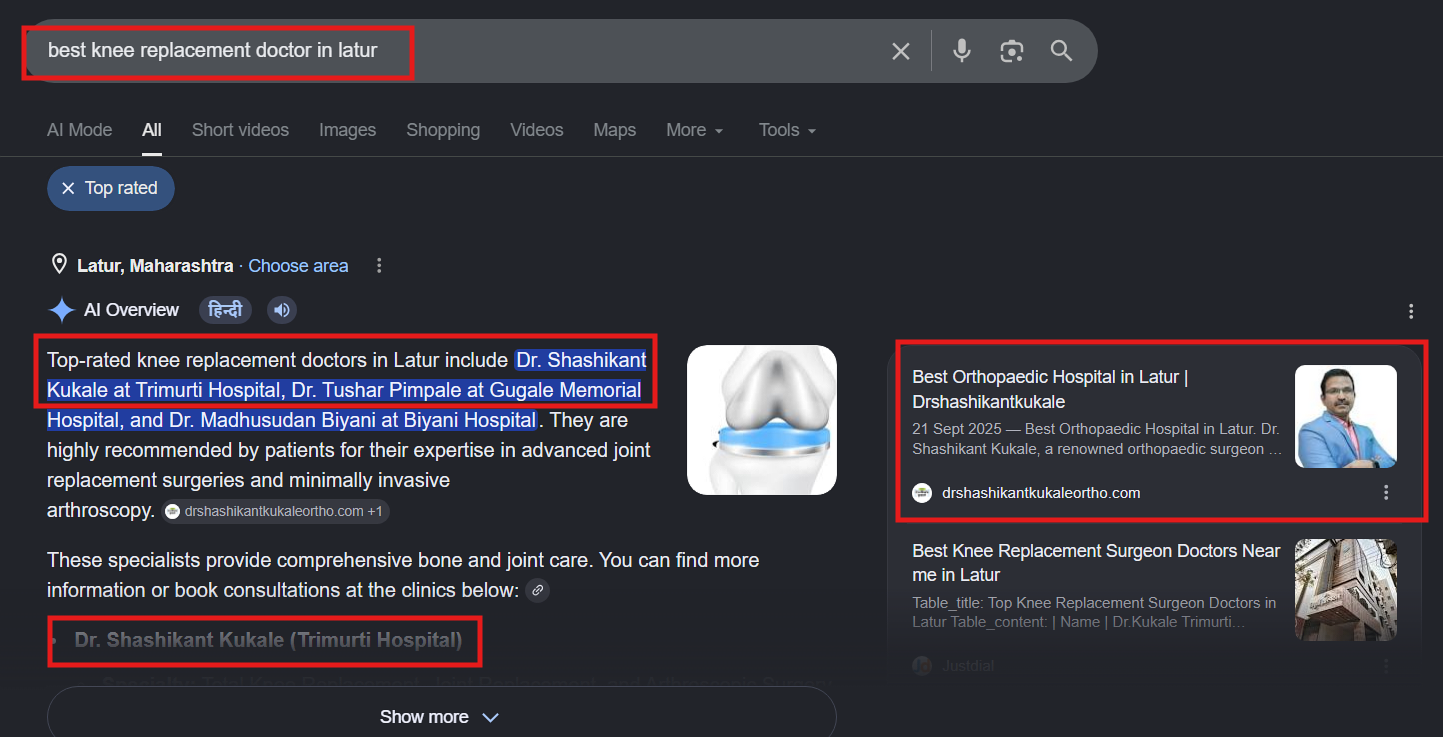 Google search results showing Dr. Shashikant Kukale named first in the AI Overview for 'best knee replacement doctor in Latur'